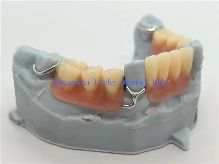 3D ispis akrilnih dijelova s T-šipčastom kopčom