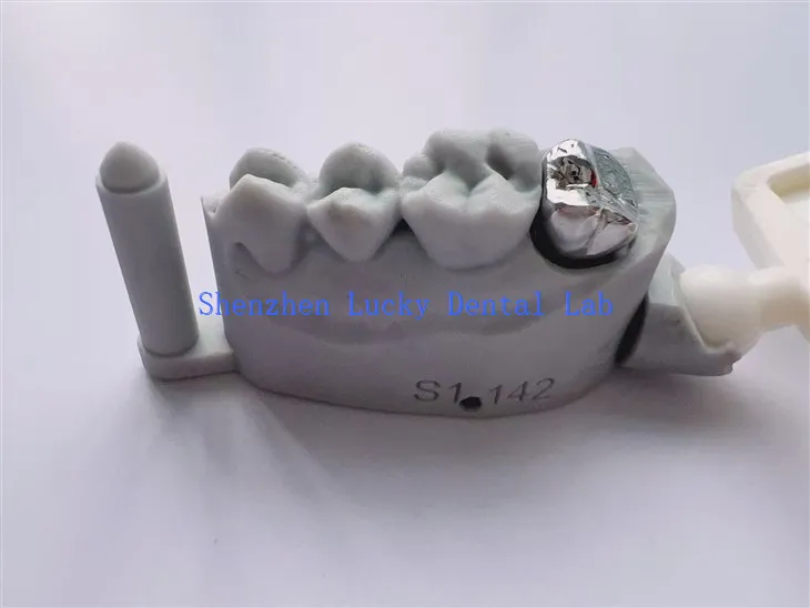 3D ispis zubnog punog metala kruna