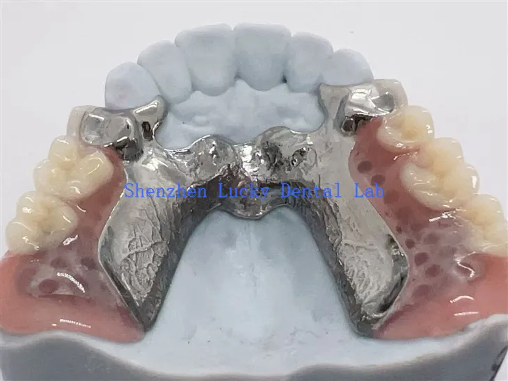 3D ispis okvira od legure titana