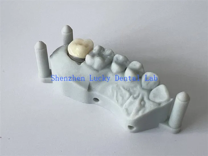 Kina 3d Print Dental All Ceramic Circonia Crown tvornica