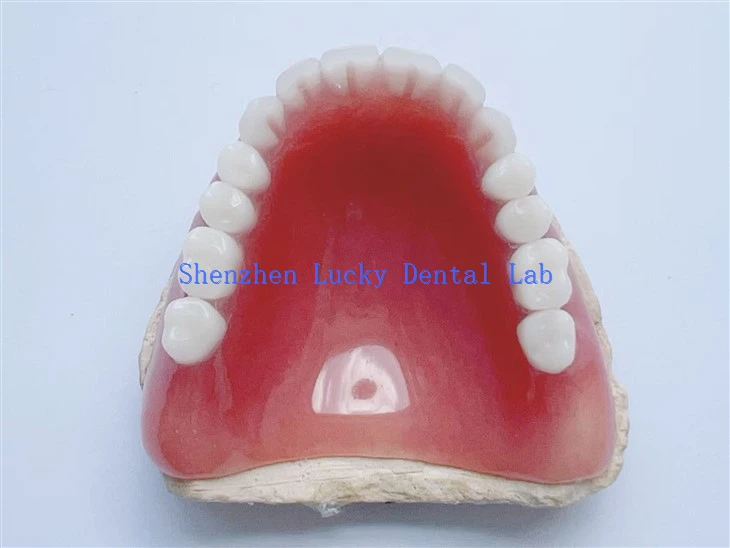 China Natural Dental Full Acrylic Denture