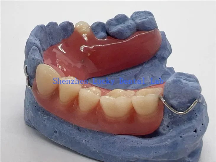 Udobna djelomična akrilna proteza sa žicom kopča