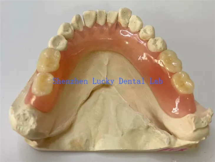 Djelomična fleksibilna zubna laboratorij proteza