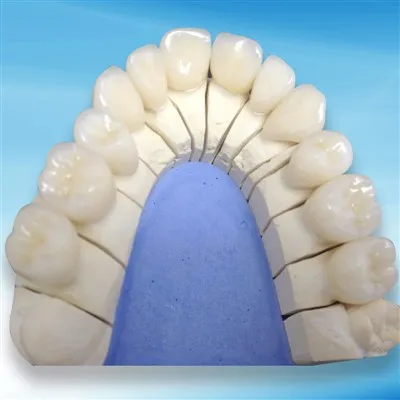 Koji su zahtjevi za održavanje zubnog cirkonija?