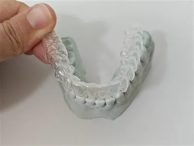 Kako funkcionira prozirni retainer?