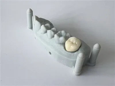 Prirodni stomatološki sve porculanski cirkonia napravljena u Kini